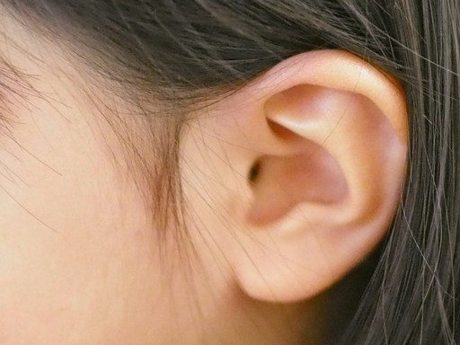 耳の整形トップ画像